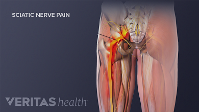 best massager for sciatica