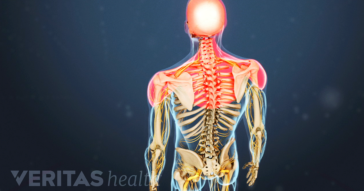 Osteoarthritis symptoms neck