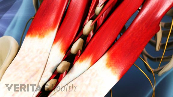 Lower Left Back Pain from Spinal Structures
