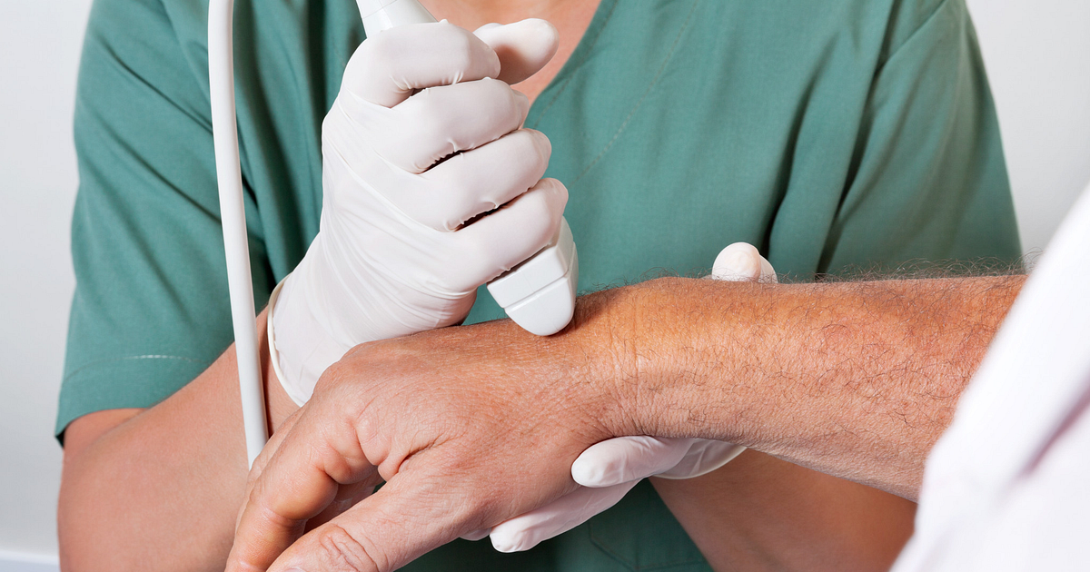 Diagnosing Wrist Tendonitis