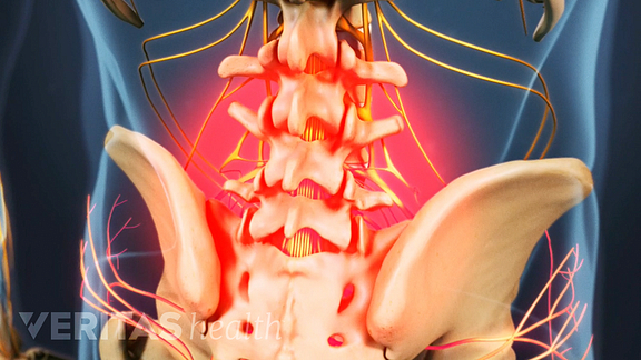 lower back pain
