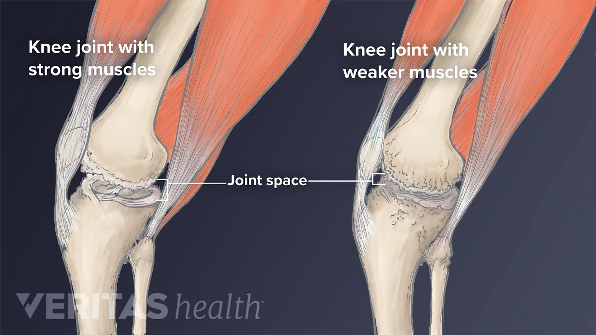 Anatomy of the Knee joint Quiz