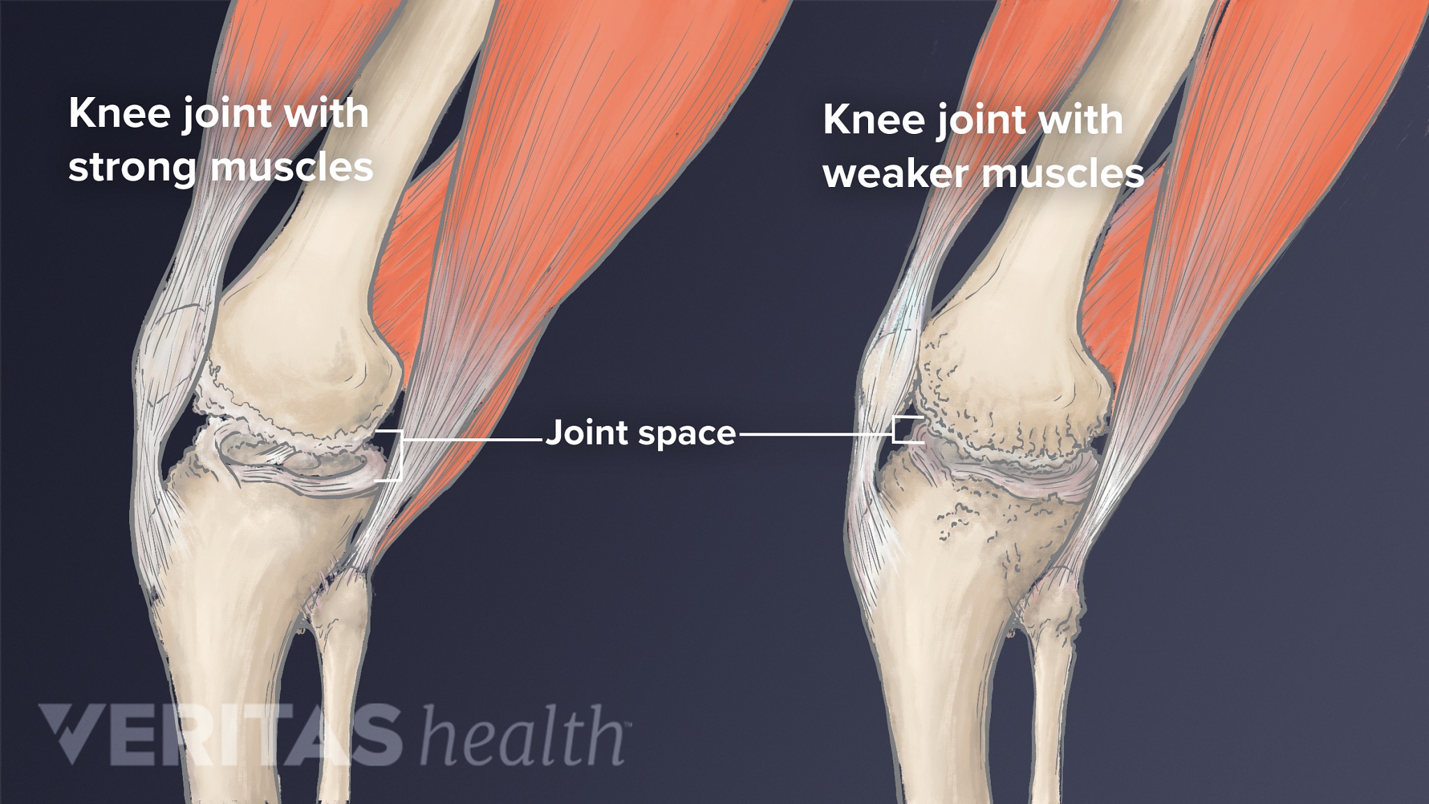 repair knee cartilage naturally