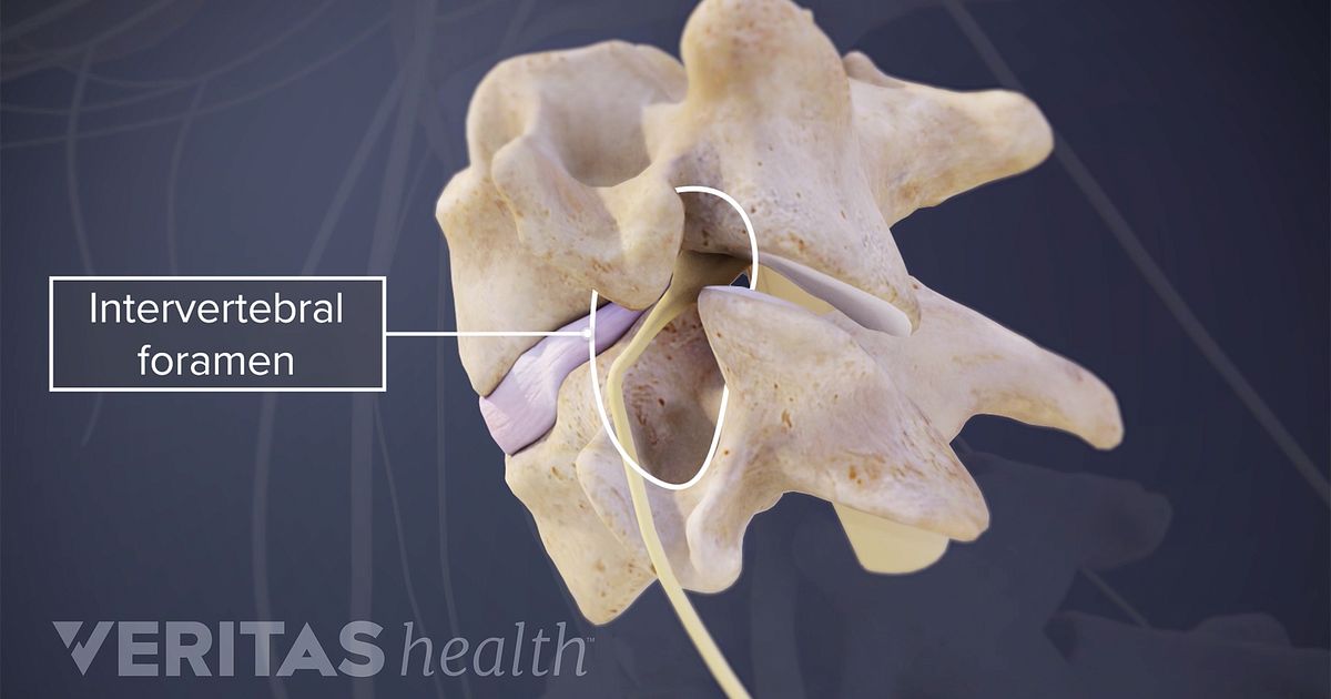 Foramen Definition | Back Pain and Neck Pain Medical Glossary