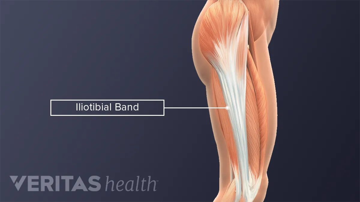 Iliotibial Band Friction Syndrome: Causes, Symptoms and Treatment