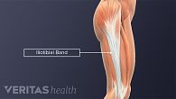 Iliotibial Band Definition | Sports Injury-Related Medical Glossary