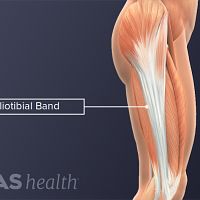 Iliotibial Band Definition | Sports Injury-Related Medical Glossary