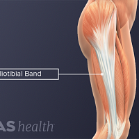 Profile view of the iliotibial band anatomy