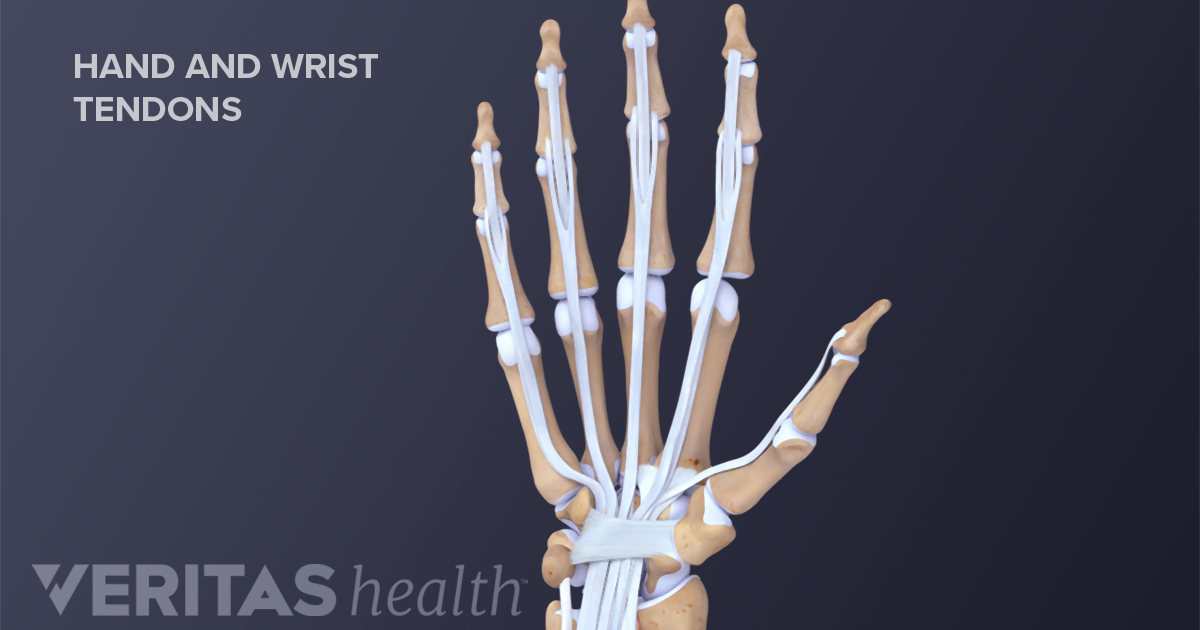 Carpal Tunnel Syndrome vs. Soft Tissue Inflammation