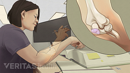 Illustration of a woman sitting at a desk with her elbow on the table. Inset shows elbow bone structure with bursitis.