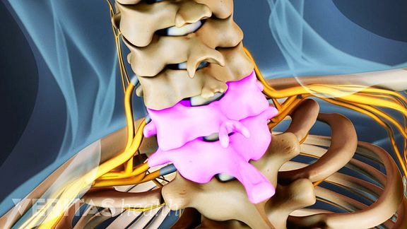 All About The C6 C7 Spinal Segment In The Neck