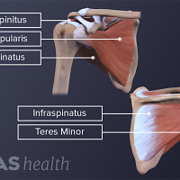 Illustration of the infraspinatus, subcapularis, supraspinatus, and deltoid rotator cuff muscles