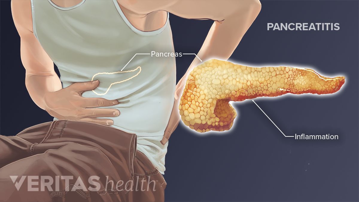 Lower Left Back Pain from Internal Organs