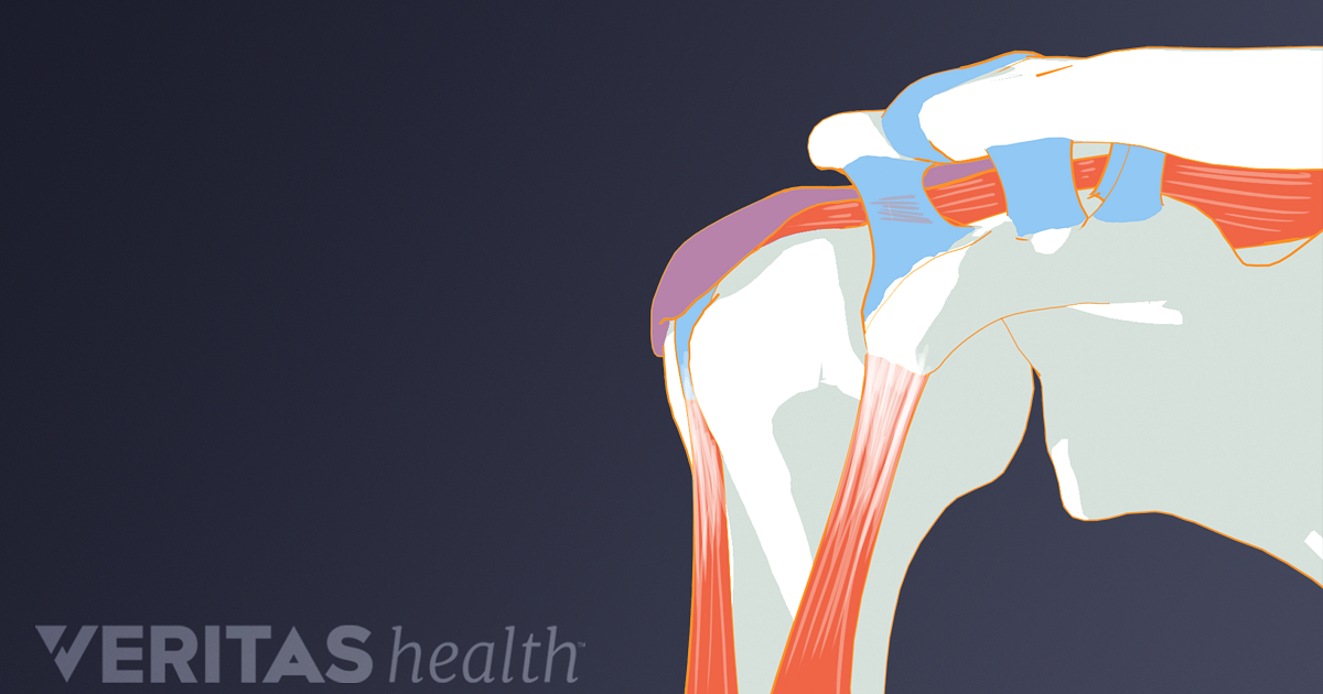 Joint Definition Defined by Arthritis-Health