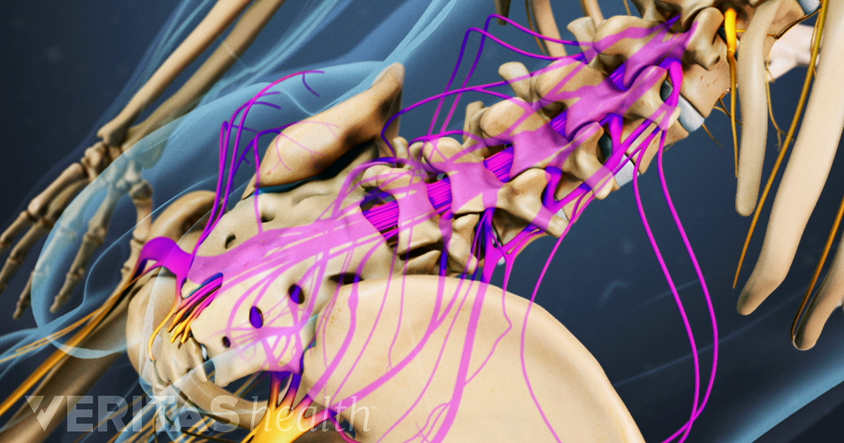 Cauda Equina Syndrome Symptoms