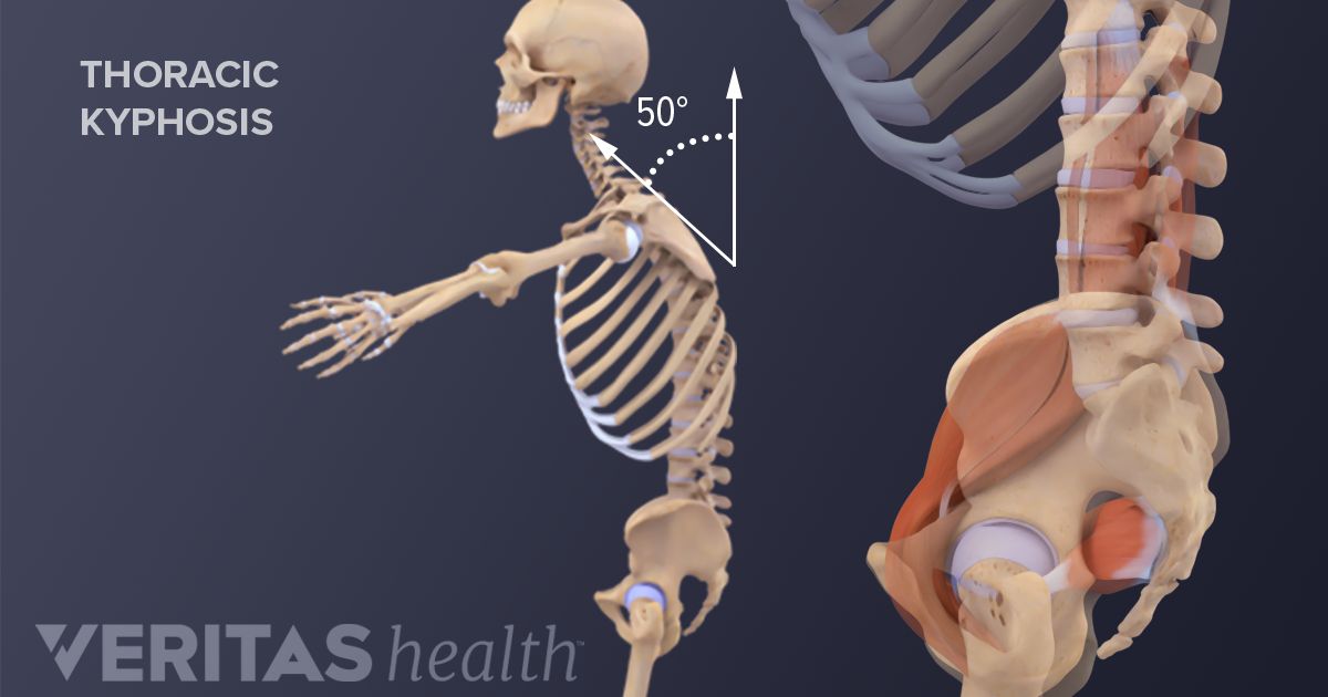 backbone definition backbone definition