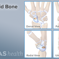 Dorsal, palm, radial, and lateral views of the scaphoid bone