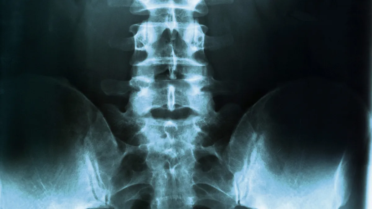 When Back Pain Is a Spine Compression Fracture