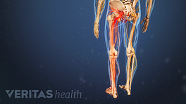 Medical illustration of the torso and upper legs. The sciatic nerve is highlighted in red