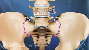 Disfunción德拉articulación骶髂