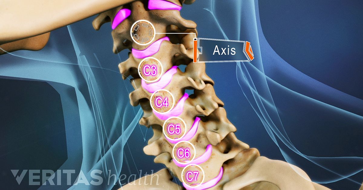 Occipital Neuralgia Full Health Secrets