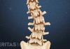 Posterior view of curvature in the lower spine from degenerative scoliosis.