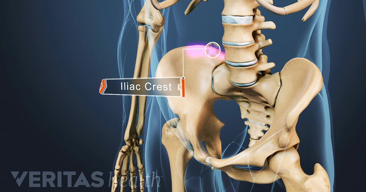 Iliac Bone Definition | Back Pain and Neck Pain Medical Glossary