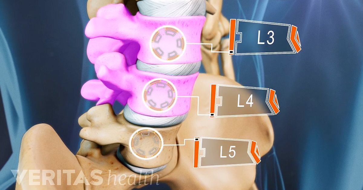 Lumbar Degenerative Disc Disease DDD lumbar-degenerative-disc-disease-ddd