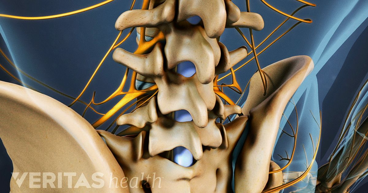 Posterolateral vs. Interbody Fusion: The Two Main Approaches to Spinal ...