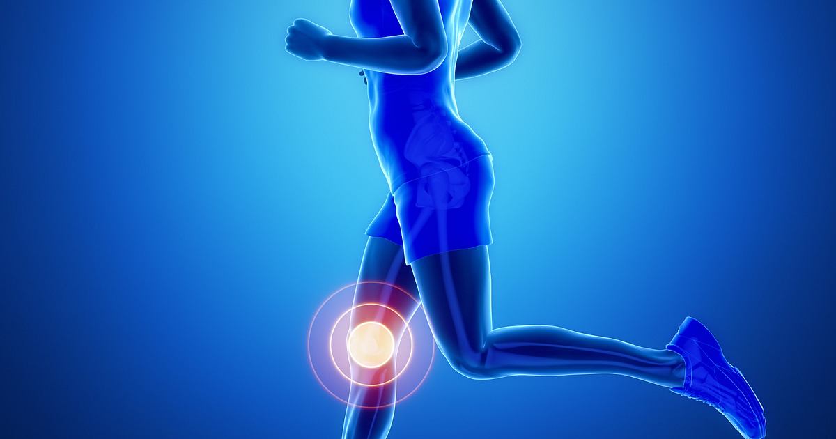 Running May Prevent—Not Cause—Knee Osteoarthritis