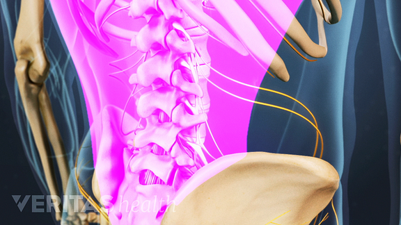 muscle strain in the lower back