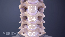 Anterior view of the cervical spine showing C3-C6.