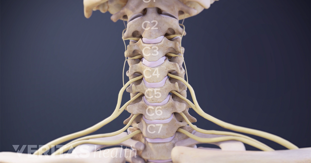 cervical spine nerves impingement x ray