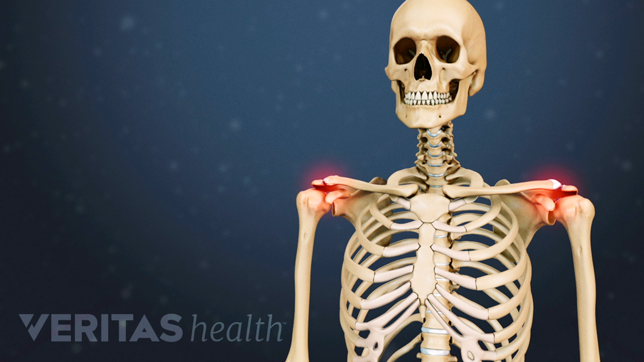 Illustrated skeleton with a red glow in the shoulder joint indicating pain