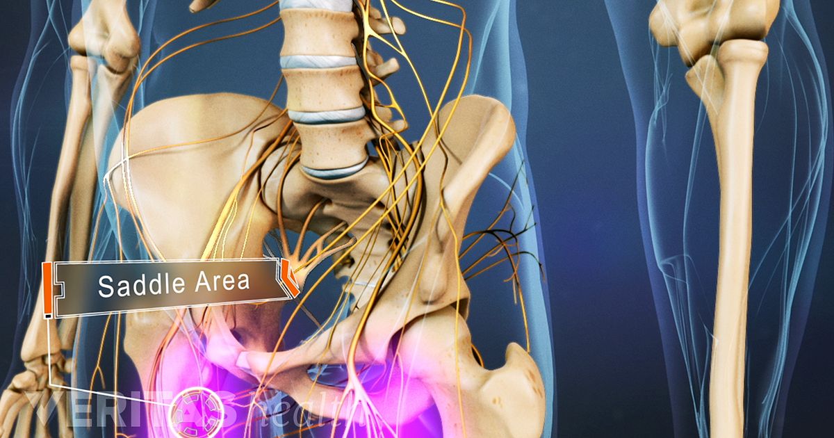 Causes of Cauda Equina Syndrome