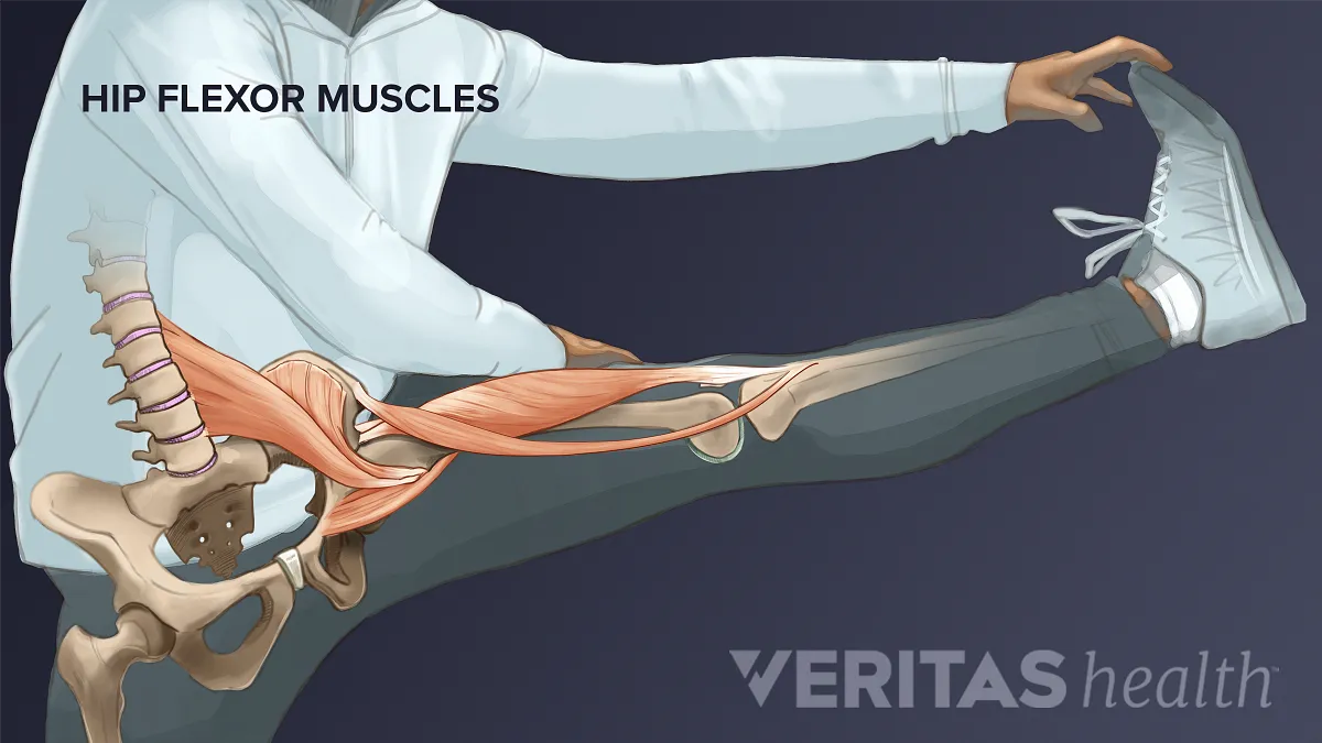Weak Hip Flexors: Signs, Symptoms, and How to Treat Them - Orthopedic &  Sports Medicine