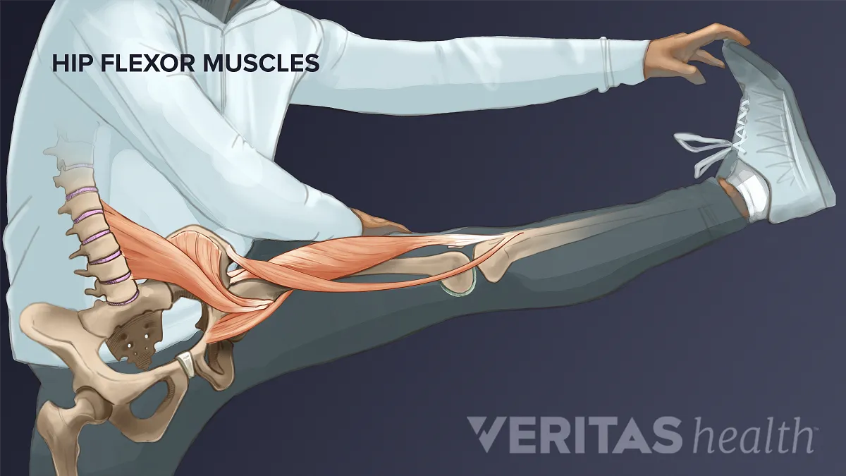 Hip Flexor  Relation of Hip Flexor Tightness to Knee & Low Back Pain