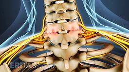 medical illustration of the cervical spine