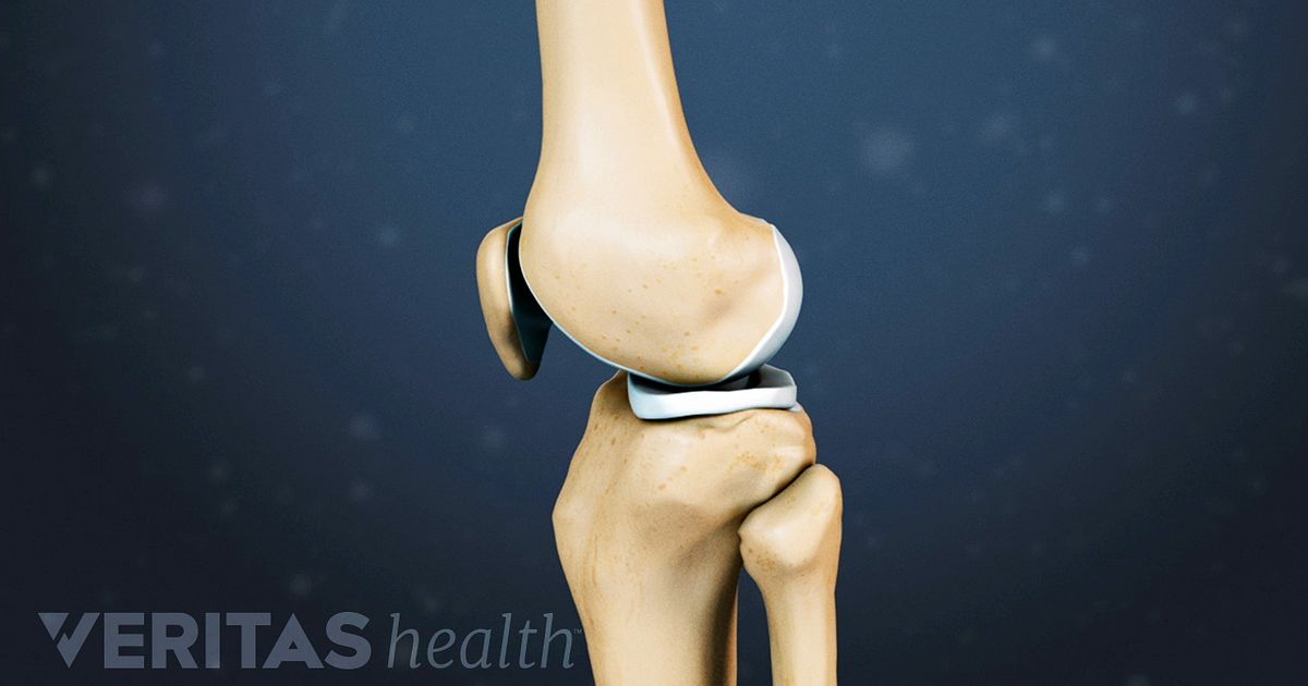 Knee Cartilage Repair, Regeneration, and Replacement