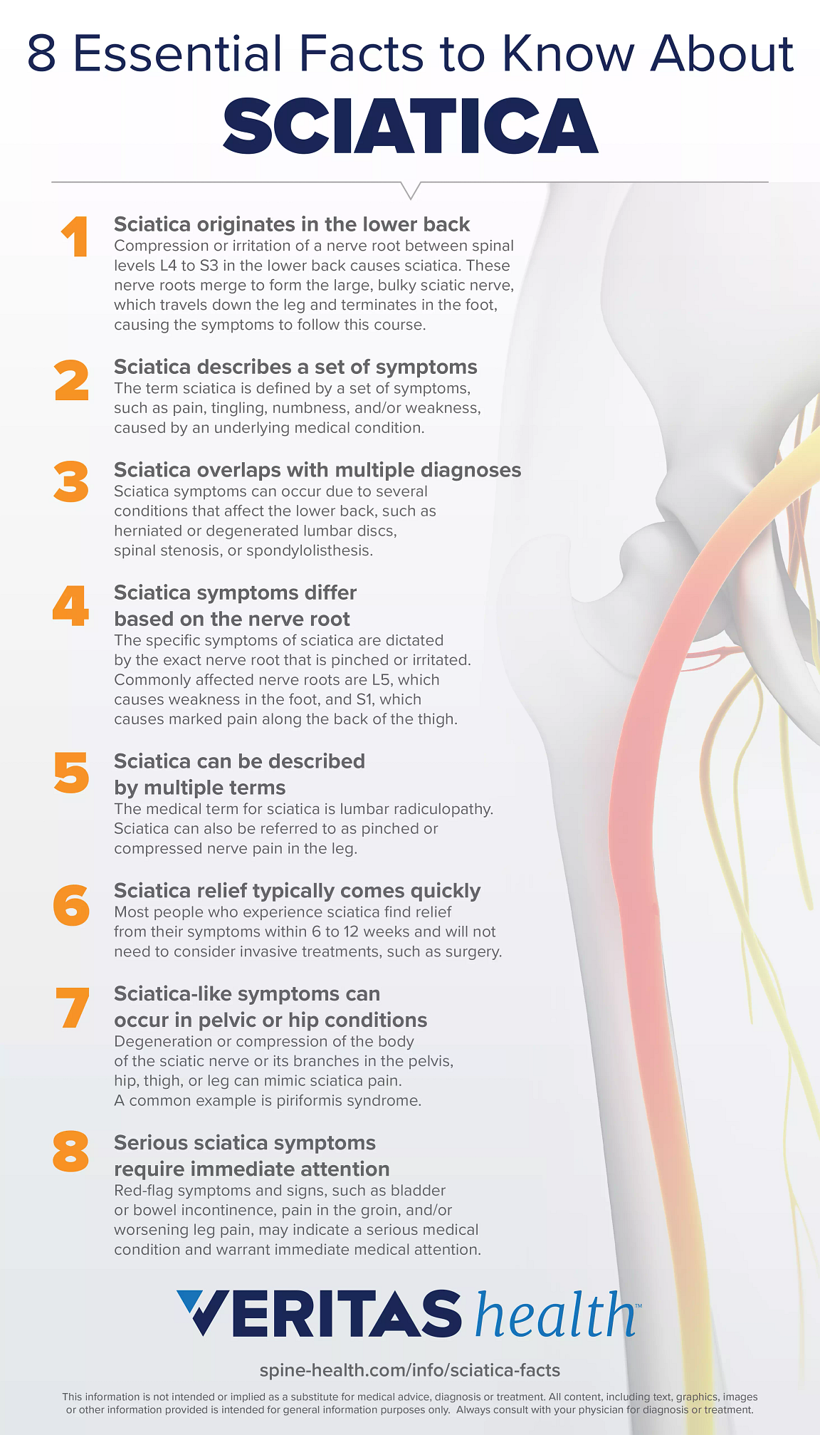 Sciatica Chart