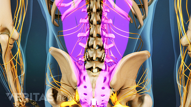 photo Stenosis Of The Lower Spine lumbar laminectomy surgery for spinal