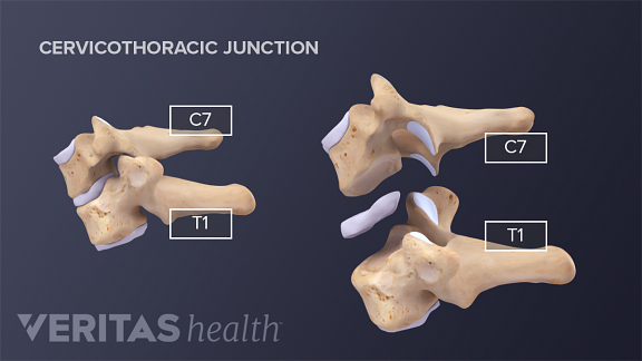 Cervical Vertebrae