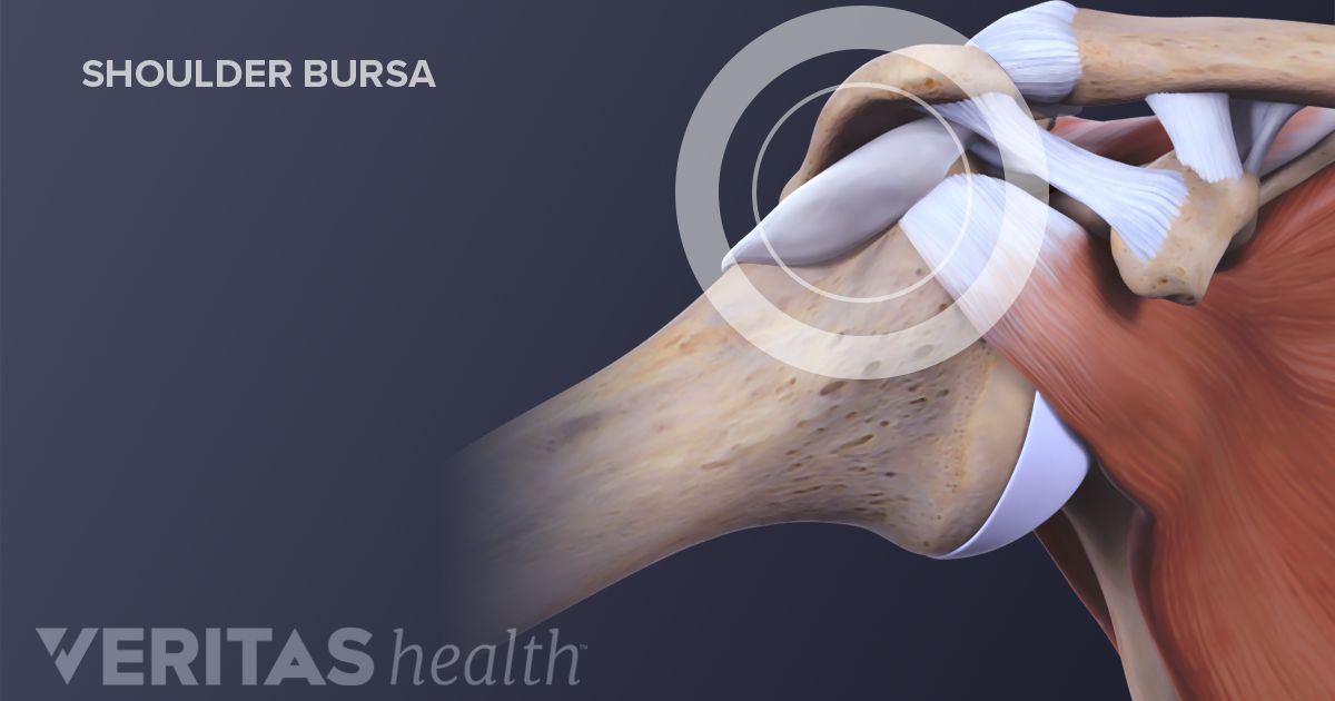 Shoulder Bursitis Diagnosis