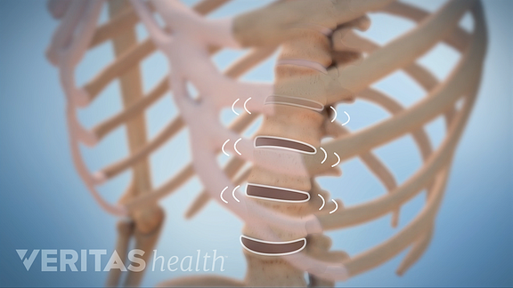 Animated video still of lumbar spine moving, causing crepitus