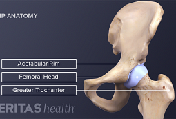 Hip Pain and Arthritis | Arthritis-Health