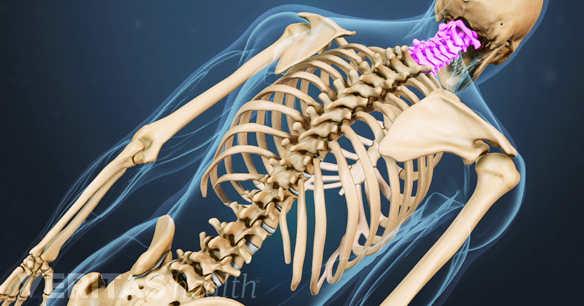 spine cancer spine cancer