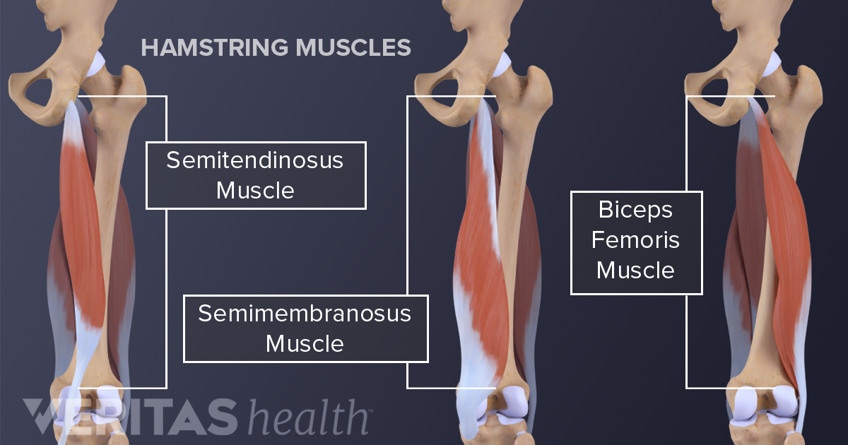 Acute Hamstring Tears