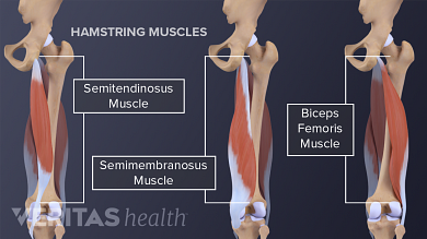 Glute hamstring tie in