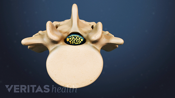 lumbar spinal canal