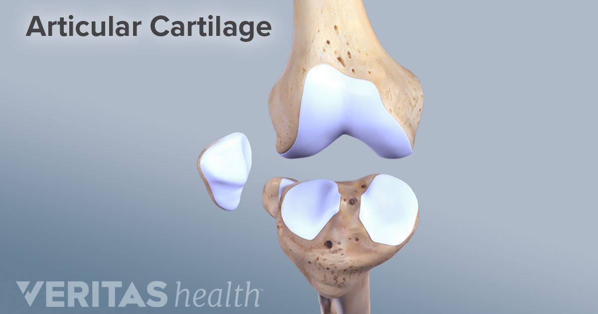 Cartilage Transplants May Offer Hope to Those with Osteoarthritis